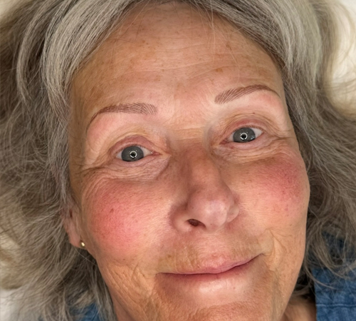 Semi Permanent Eyebrows Beau Clinic Kent