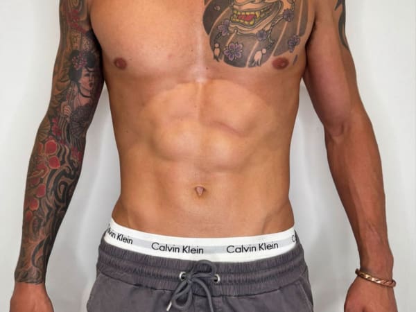 Emsculpt Body Toning Beau Clinic Kent