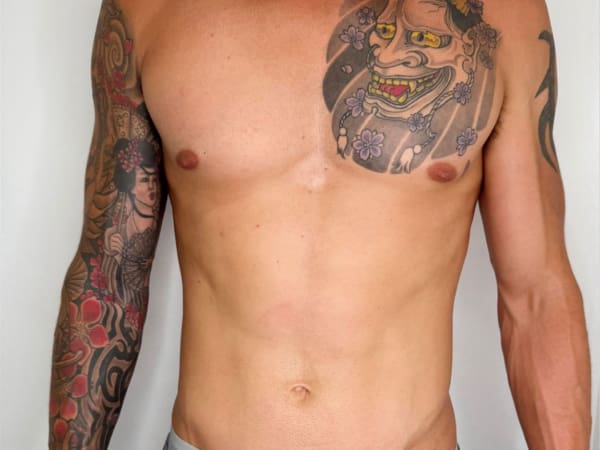 Emsculpt Body Toning Beau Clinic Kent