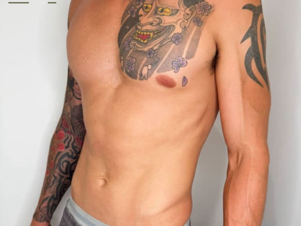 Emsculpt Body Toning Beau Clinic Kent