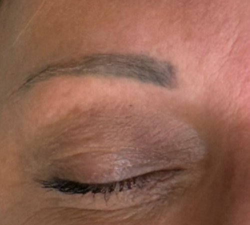 Permanent Makeup Removal Eyebrows Kent