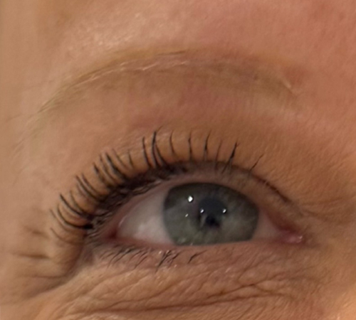 Permanent Makeup Removal Eyebrows Kent