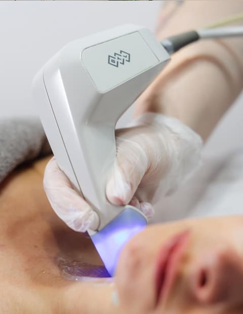 Exilis Treatment Beau Clinic Kent