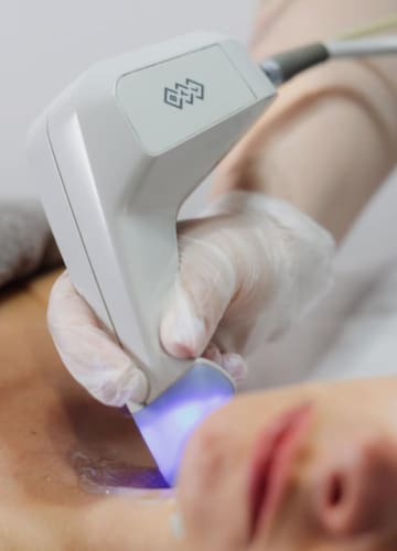 Exilis Treatment Beau Clinic Kent