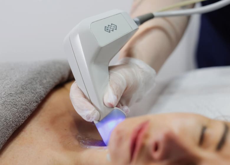 Exilis Treatment Beau Clinic Kent