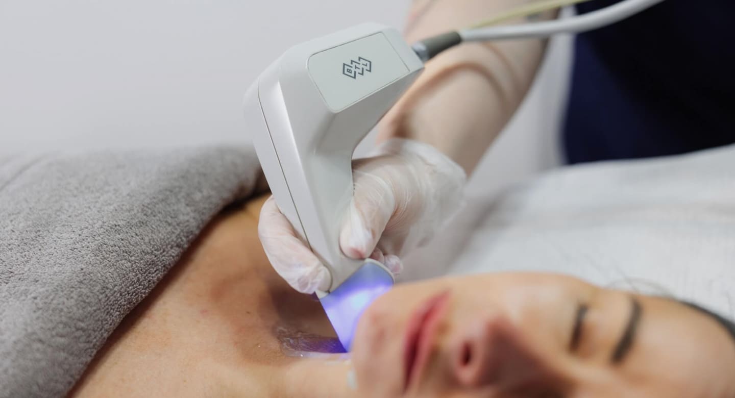 Exilis Treatment Beau Clinic Kent