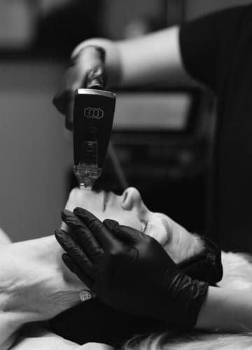 Morpheus8 Skin Tightening Beau Clinic Ashford Kent