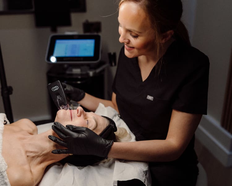 Morpheus8 Before and After Beau Clinic Kent