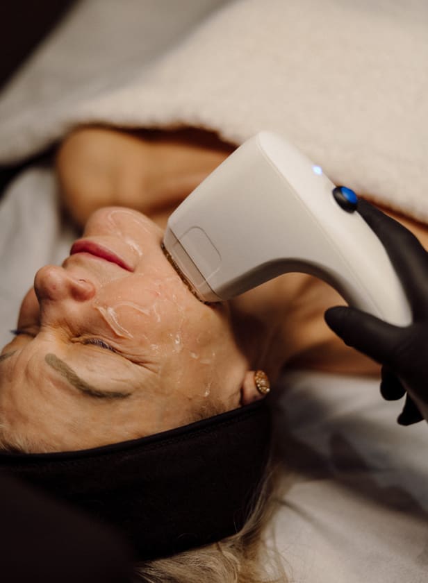 Sofwave Beau Clinic Kent Skin Lifting