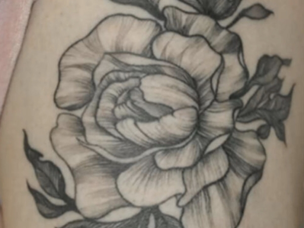 Picofy Tattoo Removal Kent