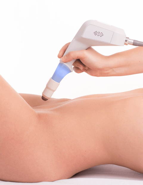 Ultra Femme 360 Vaginal Rejuvenation Kent